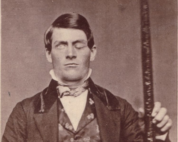 The Fascinating Case of Phineas&nbsp;Gage